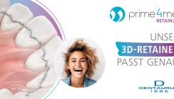 prime4me® RETAIN3R - Unser 3D-Retainer passt genau