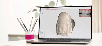 productTeaserImage