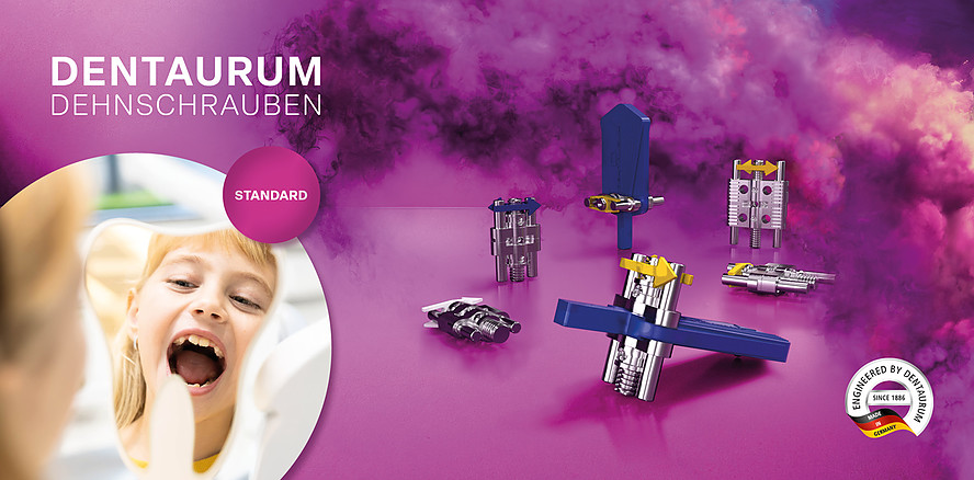 Dentaurum Dehnschrauben – Vielfältig, hochwertig und Made in Germany