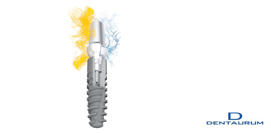 Einzigartiger Abutment Switch: Konus oder Zylinder für ein System