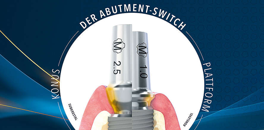 Dentaurum erweitert das digitale Implantat-Sortiment von tioLogic® TWINFIT