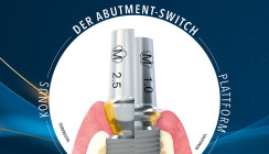 Dentaurum erweitert das digitale Implantat-Sortiment von tioLogic® TWINFIT