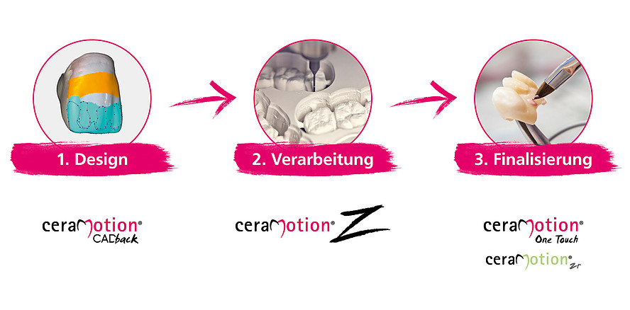 Keramik: effizienter, flexibler, digital – der ceraMotion® Workflow von Dentaurum