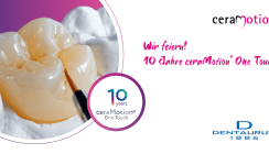 Dentaurum feiert! 10 Jahre ceraMotion® One Touch.