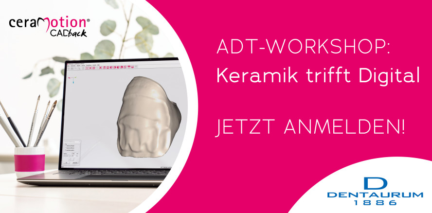 Anmeldung zum Dentaurum Workshop auf der ADT 2025