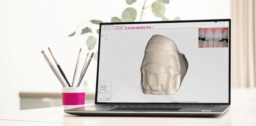 ceraMotion® CADback – die Kreativ-Software für Keramiker!