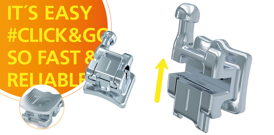 Neuzugang bei der Premium-Bracketfamilie discovery®: discovery® smart sl