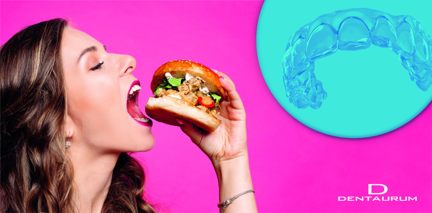 prime4me® Aligner – Alignertherapie von Dentaurum