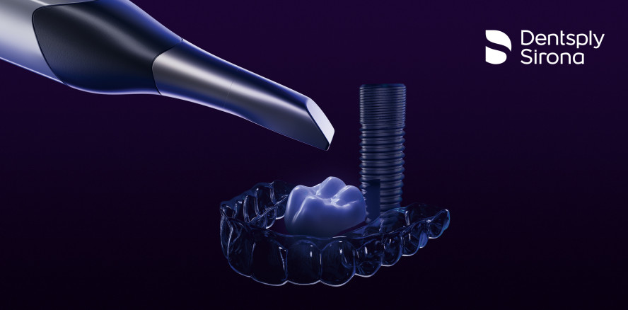 Dentsply Sirona: Digitale Abformung mit Primescan