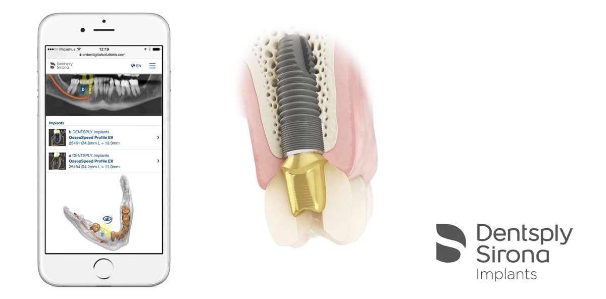 Unterstützung für den gesamten Implantat-Behandlungsprozess