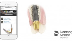 Unterstützung für den gesamten Implantat-Behandlungsprozess
