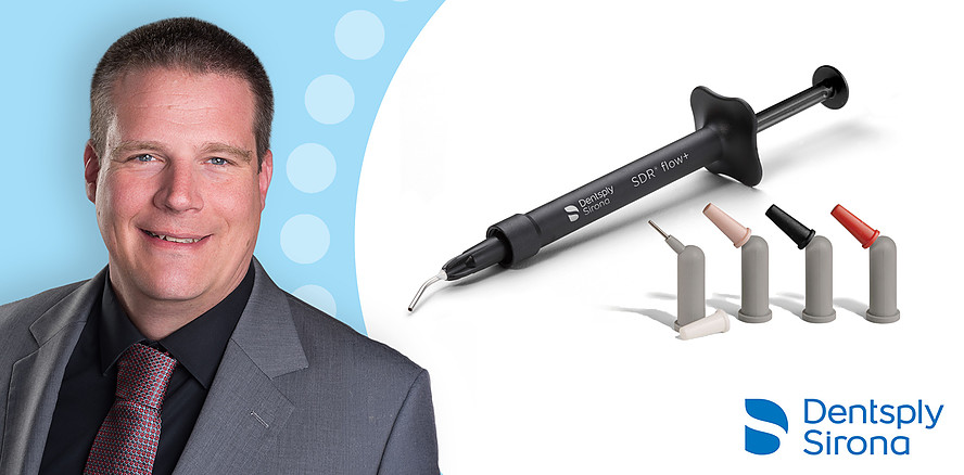 SDR® flow+: Ein fließfähiges Bulk-Fill-Komposit für lückenlose Adaption in tieferen Kavitäten