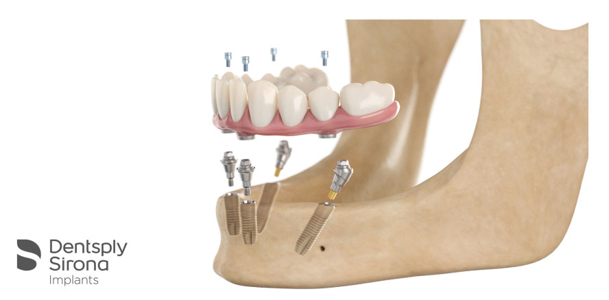 Die smarte Sofortversorgung
