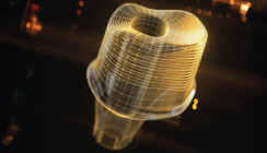 Dentsply Sirona startet Atlantis® Abutment Milling Service auf DS Core