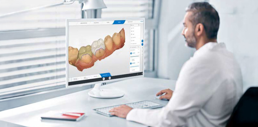 CEREC® Software 5.3 Update: für ein hohes Maß an Flexibilität