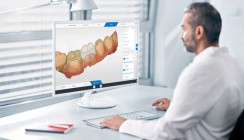 CEREC® Software 5.3 Update: für ein hohes Maß an Flexibilität