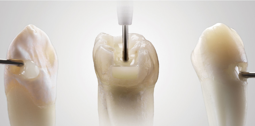 Das Original mit 120 Mio. Applikationen: SDR flow+