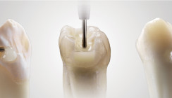 Das Original mit 120 Mio. Applikationen: SDR flow+