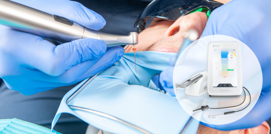 Erfolgreiche Endodontie durch Fehlervermeidung