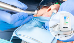 Erfolgreiche Endodontie durch Fehlervermeidung