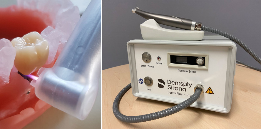 Neues Verfahren für die Peri­implantitisbehandlung entwickelt