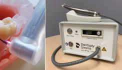 Neues Verfahren für die Peri­implantitisbehandlung entwickelt