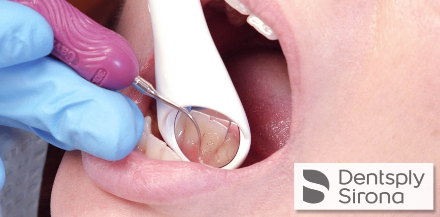 Praktisch: Spiegel und Speichelsauger in einer Hand