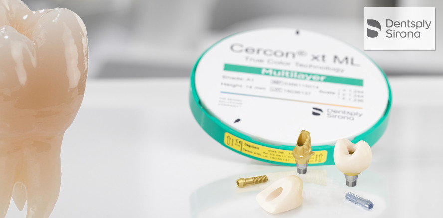 Dentsply Sirona: Atlantis-Kronen jetzt mit Cercon xt ML hergestellt