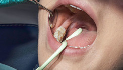 Hygoformic® Speichelzieher