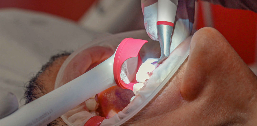 GBT: Prophylaxe gewinnbringend gestalten