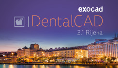 exocad führt DENTALCAD 3.1 RIJEKA mit 45 neuen Funktionen ein