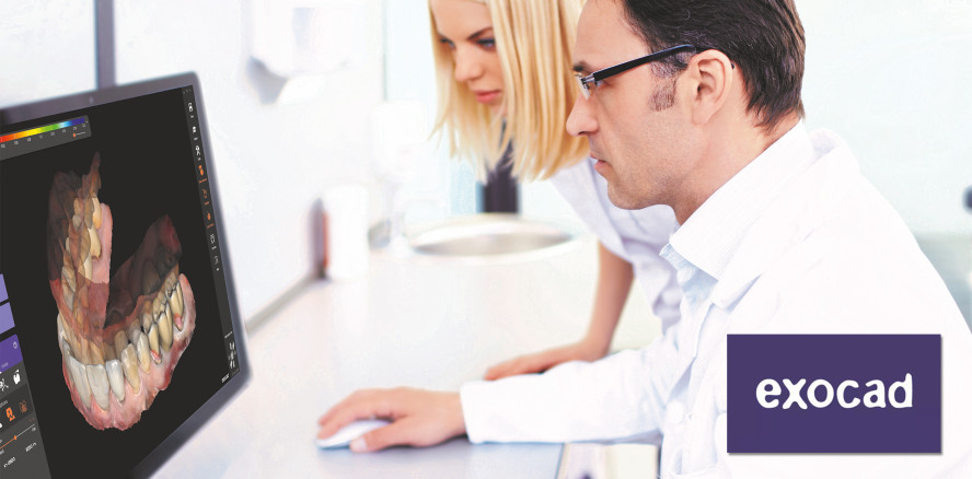 exocad veröffentlicht ChairsideCAD 3.0 Galway für Single-Visit-Dentistry