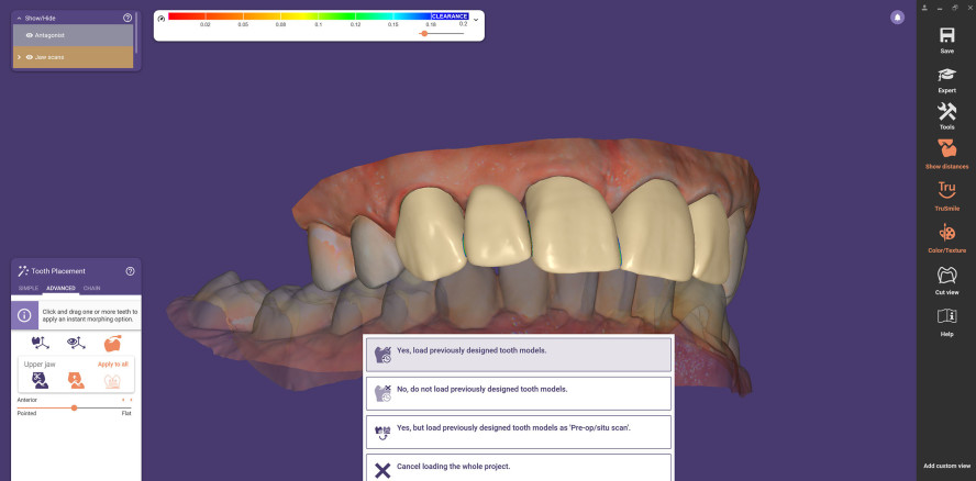ChairsideCAD 3.1 Rijeka mit vielen neuen Features
