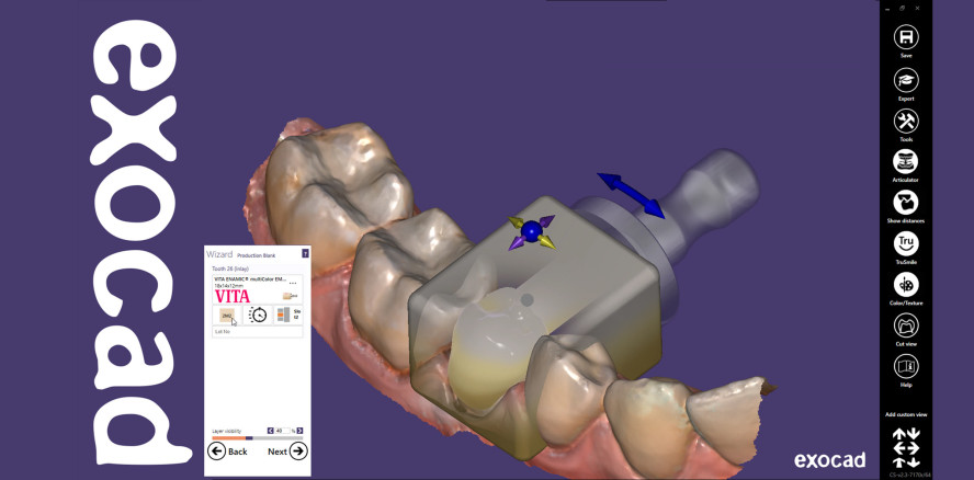 exocad präsentiert Produkthighlights auf der IDS