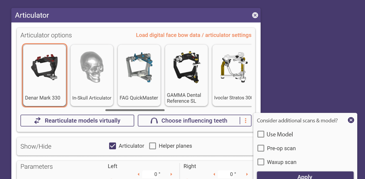 exocad gibt neuen Feature Release für DentalCAD 3.2 Elefsina bekannt