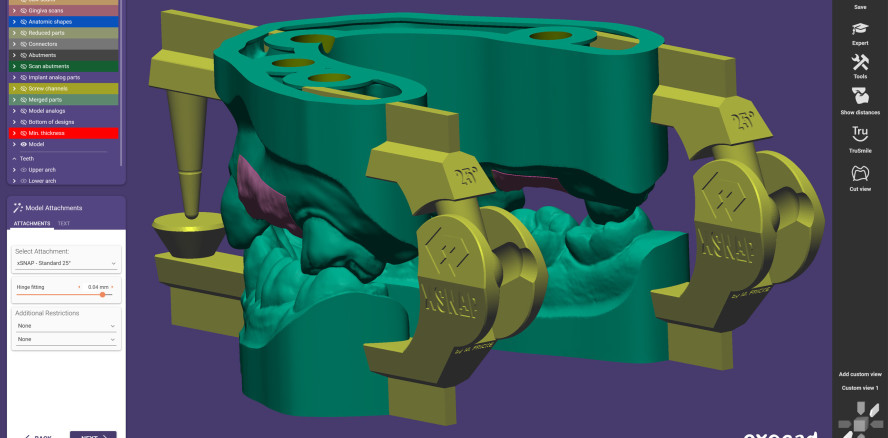 xSNAP ist das neue Add-on Modul von exocad für druckbare Artikulatoren