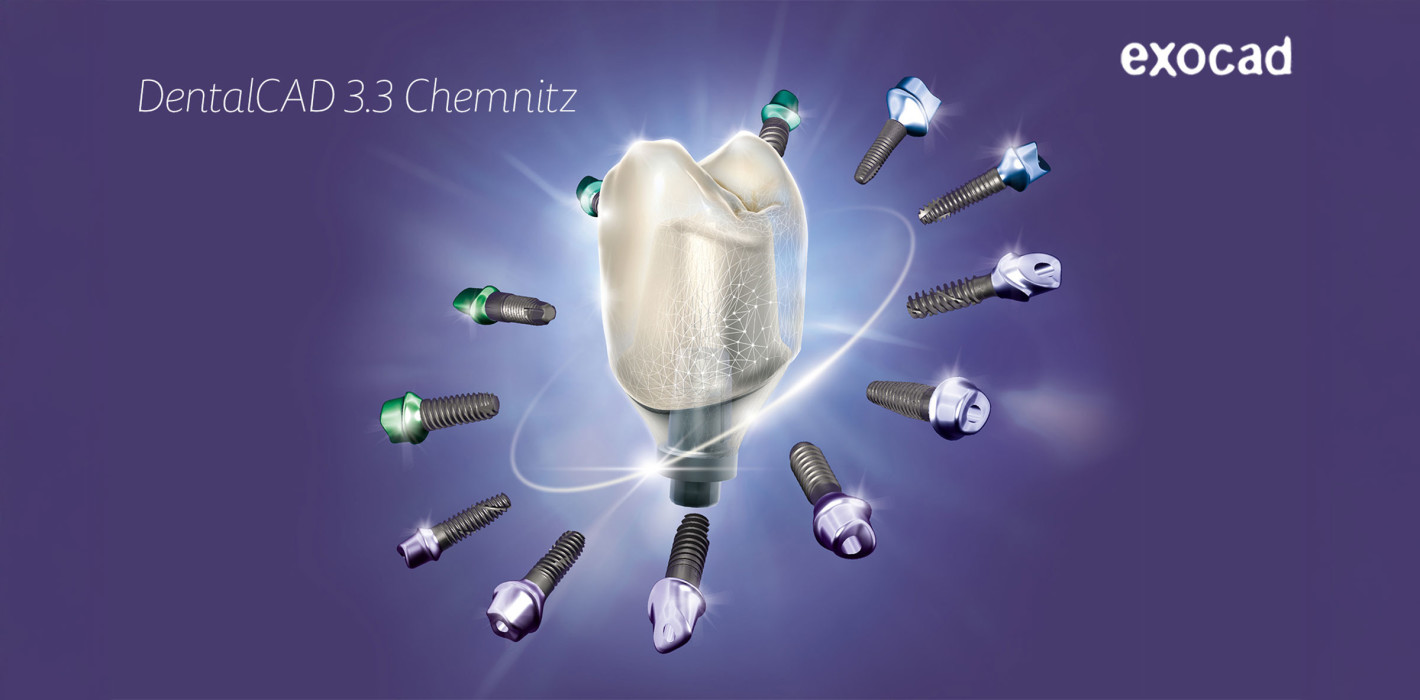 exocad bringt sein neuestes Release DENTALCAD 3.3 CHEMNITZ auf den Markt