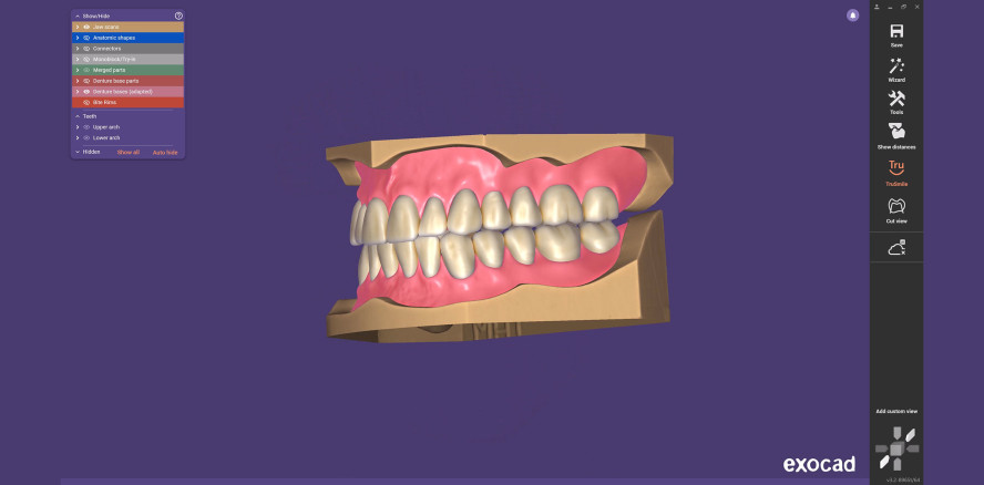 exocad veröffentlicht Inspira® Denture Tooth Library