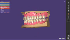 exocad veröffentlicht Inspira® Denture Tooth Library