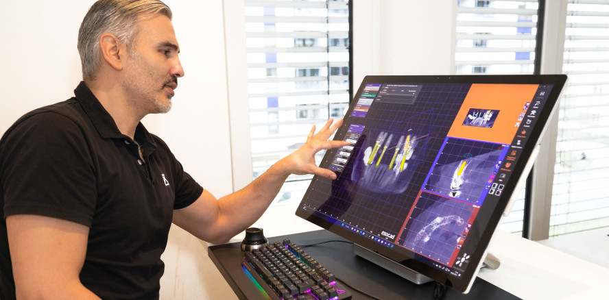 exocad veröffentlicht die exoplan 3.1 Rijeka Software