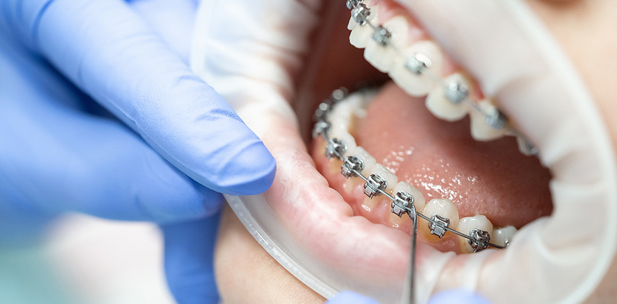 FVDZ: Gesetz ist verfassungswidriger Eingriff in Berufsfreiheit