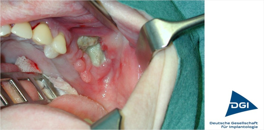 Mit falscher Vorsicht in die Rechtsfalle