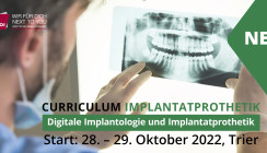 Implantatprothetik von analog bis digital mit der DGOI