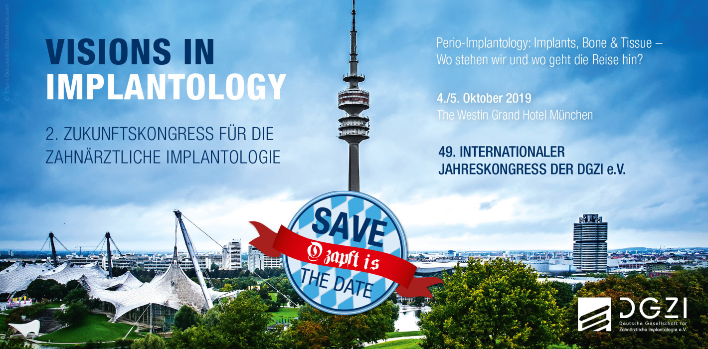 2. Zukunftskongress der DGZI mit Live-OPs & Table Clinics