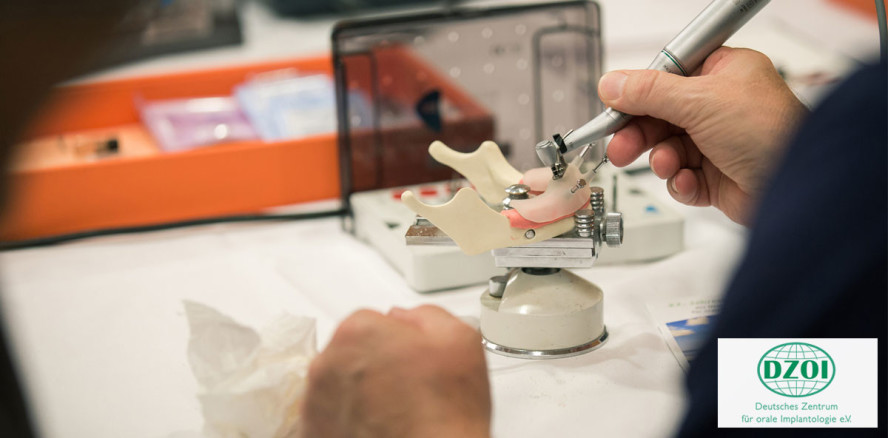 Digitalisierung in der dentalen Implantologie