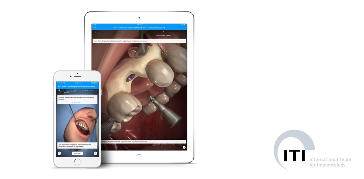 ITI und Touch Surgery kooperieren im Bereich didaktischer Simulationen