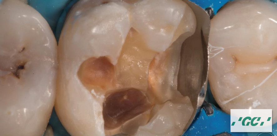 GCs digitale Formate bringen Fortbildung in Praxen und Labore