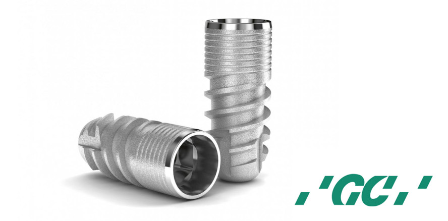 GC Aadva Implantate scheinen marginalem Knochenabbau vorzubeugen