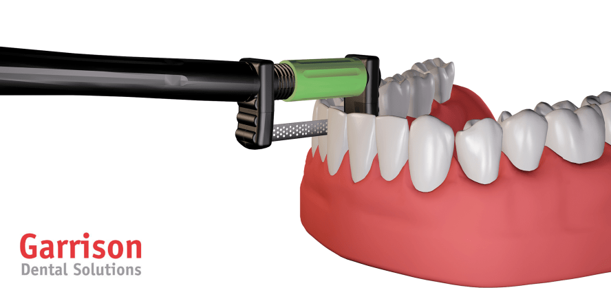 FitStrip™ Finier- und Konturiersystem zur Gestaltung von Approximalkontakten