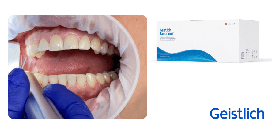 Mehr Komfort und Effizienz mit dem Geistlich Panorama® Retraktor